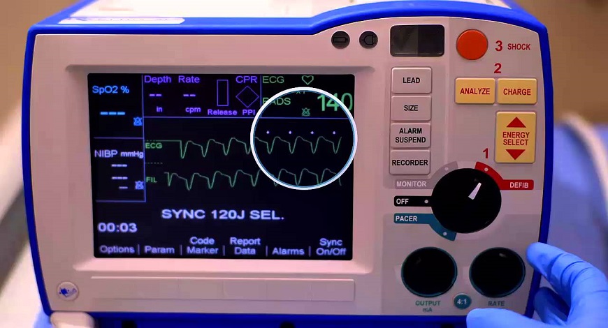 Defibrillator Manufacturers in India